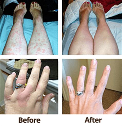 Your doctor can identify allergic reactions. How To Discover The Nature Of An Allergic Reaction - Top ...