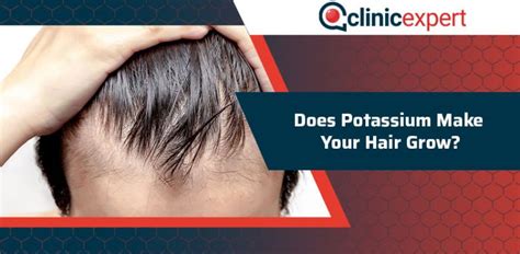 Let me know what you think about it too. Does Potassium Make Your Hair Grow? | ClinicExpert ...