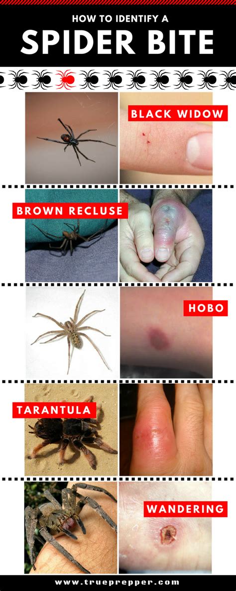 The black widow bite spider is undoubtedly the most toxic species of the creature. How to Identify a Spider Bite - TruePrepper