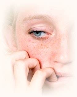 Asperger syndrome (as) is a severe developmental disorder characterized by major difficulties in social interactio and restricted and unusual patterns of interest and behavior. Thriving with Neurofibromatosis: Life with Aspergers Syndrome