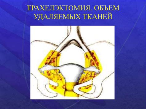 Погода в мире на сегодня, завтра и неделю. Рак шейки матки (клиника, диагностика, лечение ...