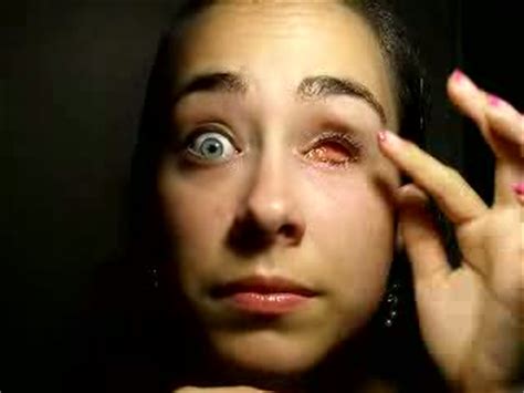 Magasinez dès aujourd'hui et obtenez les plus bas prix grâce à notre garantie d'égalisation des prix. Fille avec un oeil de verre