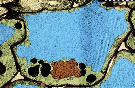 We did not find results for: Colour TEM of flaccid cell after stimulation - Stock Image ...