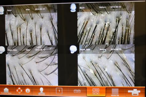 Yun nam hair care has been recognized for using premium ginseng, dang gui and other exquisite chinese herbs to greatly increase hair growth and significantly reduce hair fall. Yun Nam Hair Care Review: Progress Update - Regina Chow ...