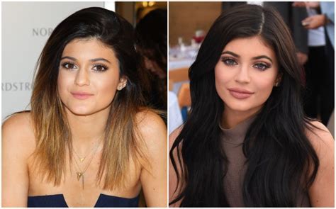 Kylie jenner is a knockout alright, but the reality tv star took pains to enhance her appearance with plastic surgery. Kylie Jenner After & Before Pictures: Did She Do Surgery ...