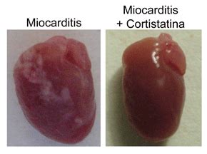 Si una infección subyacente causa miocarditis, lo más probable es que primero se trate al paciente por esa infección. La sustancia que protege al corazón