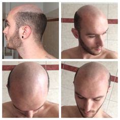 12 Best Fringes images | Male pattern baldness, Bald men ...