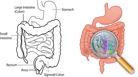 Gastritis akut akan menyebabkan nyeri ulu hati yang hebat, namun hanya bersifat sementara. Gastritis Merupakan Panyakit Karena Gangguan ? : Gastritis ...