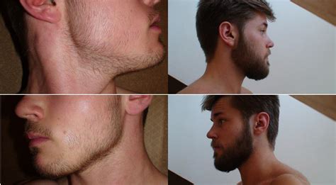 After six months, you should start to see some improvement, with final results usually visible after approximately one year of continuous usage. How to use Minoxidil and Rogaine to Thicken Facial Hair ...