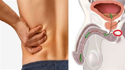 'the number of reports is low in relation to the number of women who have had the vaccine to date and the background rate of menstrual disorders generally. 10 cancer symptoms men should not ignore | Funmy Kemmy's ...