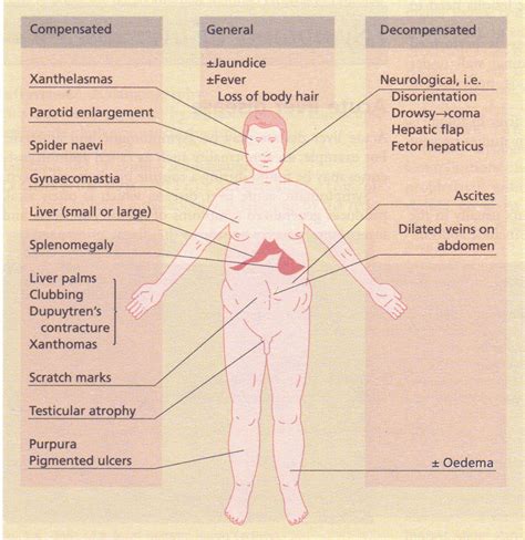 It sits just under your rib cage on the right side of your abdomen. Signs of liver disease Assignment Help & Homework Help