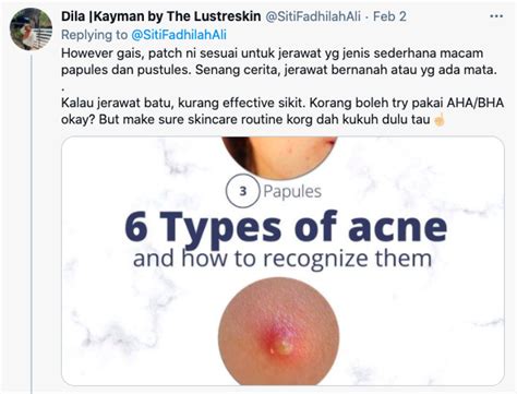 Ada beberapa bahan alami yang dapat anda gunakan untuk menuntaskan masalah jerawat pada kulit. Guna 'Acne Patch', Cara Mudah Hilangkan Jerawat Biasa Atau ...