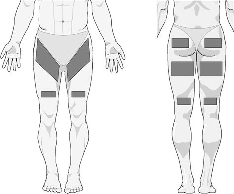 Prolonged electrical muscle stimulation exercise improves ...