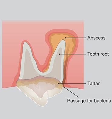 It is common for pets to experience some or all of the following mild side effects after receiving a vaccine, usually starting within hours of the vaccination. Gum Dog Mouth Abscess