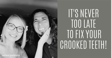 What about fixing only 1 crooked tooth? 3 Cosmetic Dentistry Procedures That Fix Crooked Teeth ...
