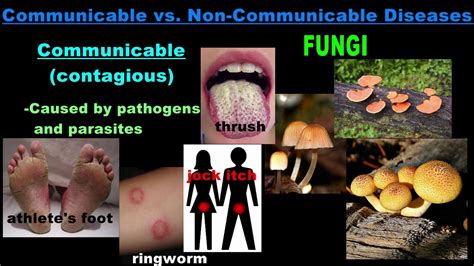 In contrast, transmissible diseases caused by pathogenic organisms are… … Is it Communicable or Non-communicable? - YouTube