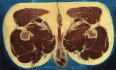 Pelvis, perineum, hip, and upper thigh male (plates 6.1 to 6.18) female (plates 6.19 to 6.34). The Visible Human Project - Color Cryosections