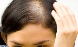 What are causes and risk factors for hair loss? Sudden Hair Loss | Natural Health Magazine