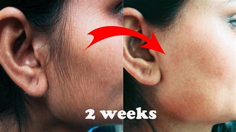 How to remove facial hair permanently: PERMANENT FACIAL HAIR REMOVAL FOR WOMEN | BEST WAY TO ...