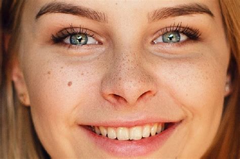 Salah satu penyebab utama bintik lemak di wajah adalah kadar kolesterol 'jahat' ldl yang terlalu tinggi di dalam tubuh. Menghilangkan Bintik Bintik Di Photoshop - 5 Cara Menghilangkan Bintik Hitam di Wajah dengan ...