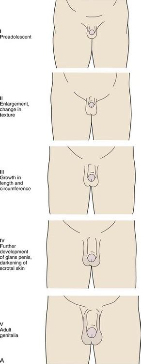In the pubic region around the pubis bone, it is known as a pubic patch. Endocrinology | Obgyn Key