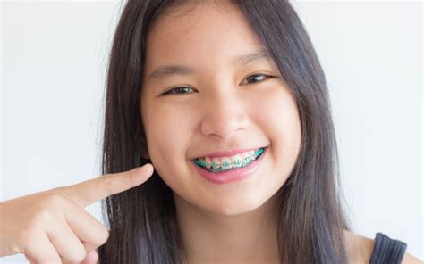 So many of our patients simply brush their teeth as they always have, ignoring the fact. How to Brush Your Teeth with Braces