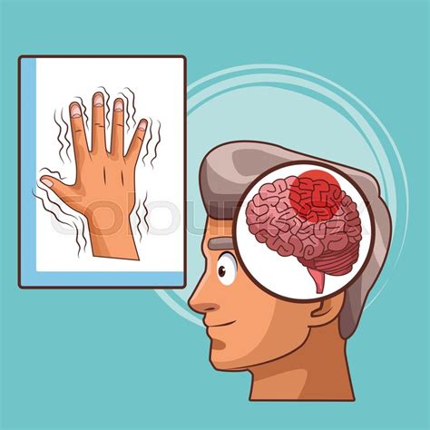 Parkinson disease videos, flashcards, high yield notes, & practice questions. Parkinsons disease cartoon icon vector ... | Stock vector ...