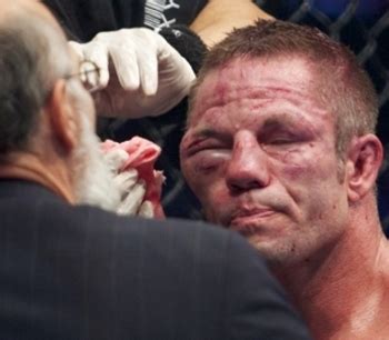 But because eye problems in cats can be caused by so many different issues—from allergies to corneal scratches—using that old medicine without an examination by your vet can cause serious problems. UFC 129: Where Does Mark Hominick's Post-Fight Face Rank ...