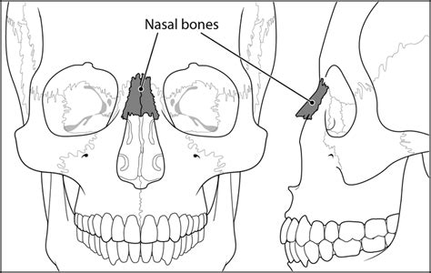 The nasal bones are two small oblong bones, varying in size and form in different individuals; Basic facial anatomy demonstrating location of nasal bones. | Download Scientific Diagram