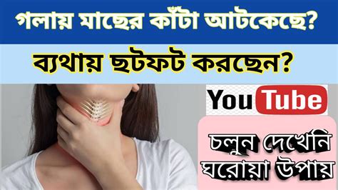 How can a fish bone stuck in the throat be removed? How To Get Fish Bones Out Of The Throat At Hom - YouTube