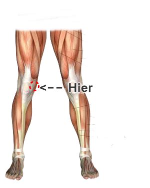 ) | in der regel kann ich meinen kunden hier entwarnung geben, das knieschmerzen haben selten etwas mit arthrose oder. Schlimme Knie schmerzen, was könnte das sein? siehe Bild ...