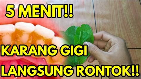 Jadi, sebaiknya anda mencegah pembentukannya. TERBONGKAR!! Cara menghilangkan Plak & Karang Gigi dan ...