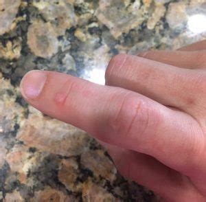 638 x 359 jpeg 62 кб. I have herpes viruses and so do YOU - The Vaccine Mom