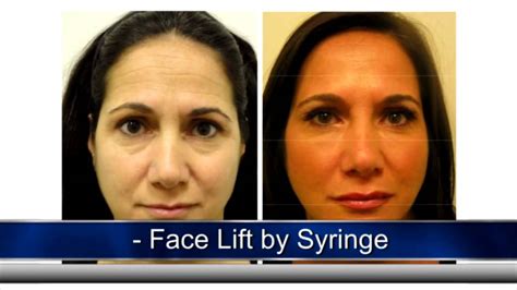 Are your lorenc ancestors on wikitree yet? Dr. Z. Paul Lorenc - Aesthetic Surgery NYC - YouTube