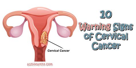 Cervical cancer is cancer that starts in the cervix. Cervical Cancer Symptoms; 10 Warning Signs of Cervical Cancer