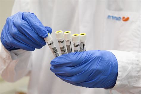 רשימת מעבדות רפואיות המאושרות לביצוע בדיקות סרולוגיה לנגיף הקורונה החדש. חיסון העדר: בדיקה סרולוגית העלתה תוצאות מפתיעות - ערוץ 20