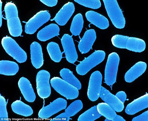 Listeria monocytogenes is a bacterium infectious to humans and causes the illness listeriosis. NHS hospital sandwiches could be contaminated with a ...