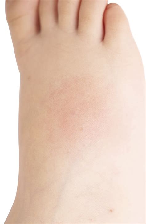 What are the best ways to reduce brain inflammation? How to Reduce Feet Swelling with Oral Vitamins ...