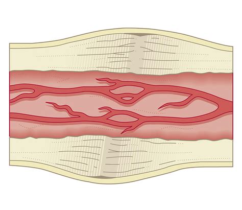 Maybe you would like to learn more about one of these? Cross Section Biomedical Illustration Of Bone Repairing ...