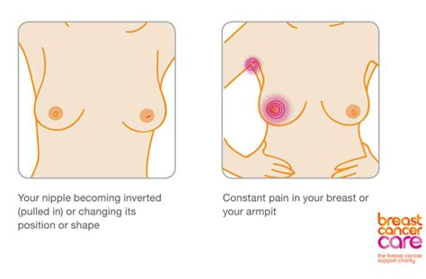 A new ad campaign from the uk shows you how to use the flash on a camera, including your phone's, to detect eye cancer in children. Signs of breast cancer: How to check your breasts