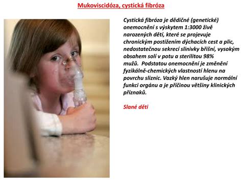 Cystická fibróza je patologie, která postihuje různé orgány v těle, zejména ohrožuje zdraví dýchacích, trávicích a reprodukčních systémů. PPT - Klinefelterův syndrom PowerPoint Presentation, free ...