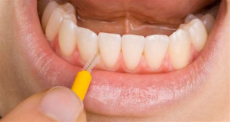 We did not find results for: ¿Cómo debemos cepillarnos los dientes? - Clinica dental Madrid