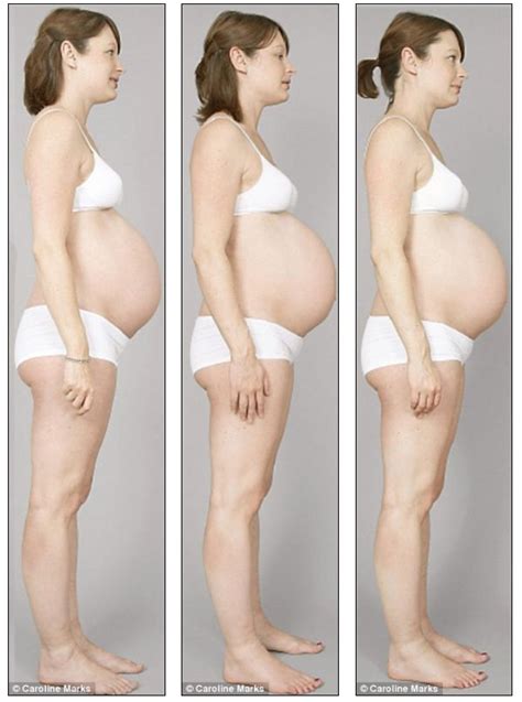 Watchful waiting, medications, and surgery are the treatment options for an ecotpic pregnancy. How belly's growing during pregnancy (8 pics) - Izismile.com