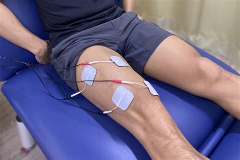 History and origin of electrostimulation, also commonly referred to as electrotherapy, is unique. Electrical Stimulation Therapy » Heartland Rehab