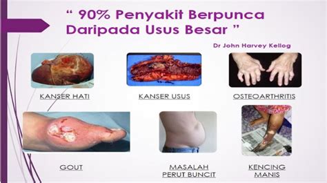 Solusi sehat menggunakan madu kelulut untuk perawatan pengobatan berbagai macam penyakit kronis dan mempercepat masa pemulihan. Madu Lebah Kelulut: FAEBR