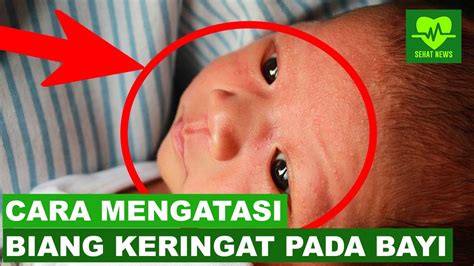 Kedua vitamin ini sangat baik karena bisa. CARA MENGATASI BIANG KERINGAT PADA BAYI - YouTube