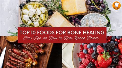 What are the stages of a broken bone? Top 10 Foods For Bone Healing Plus Tips on How to Heal ...