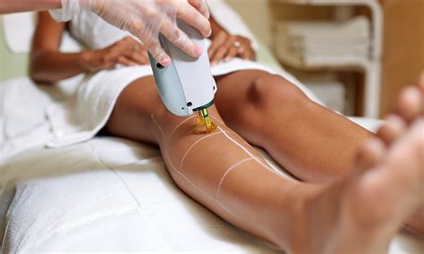 Yag 1064nm can be used on darker skin types due to its lower melanin absorption.the laser deeply penetrates the hair follicle, targeting the bulb and papilla for more. DealsLama — Laser Hair Removal at Elegance Beauty and ...