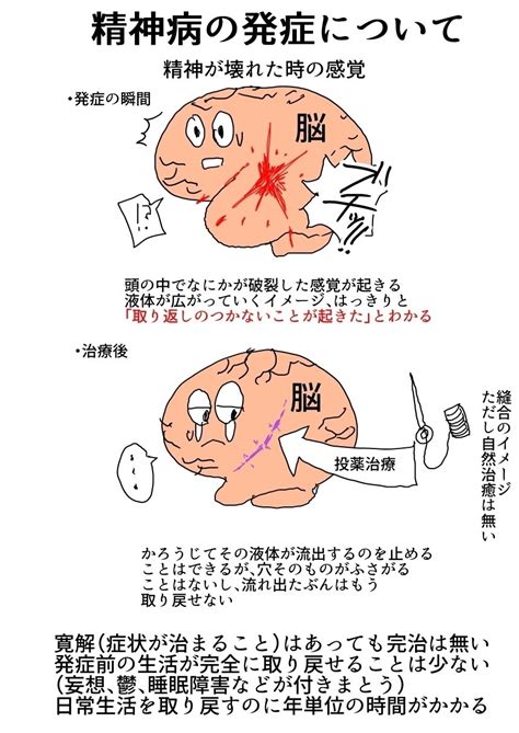 Search for text in self post contents. 精神を壊したときのための備忘録：双極性障害体験記｜nozubeya｜note