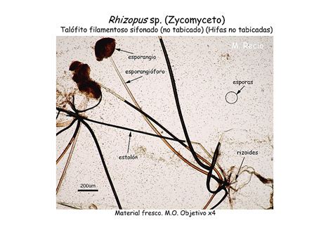 Mucormicosis gastrointestinal en paciente diabético; Hongos